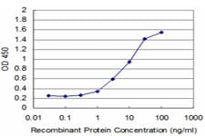 Monoclonal Mouse anti-Human PRPK / TP53RK Antibody (clone 2E8)