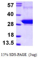 Human RAB5B Protein (Recombinant His)
