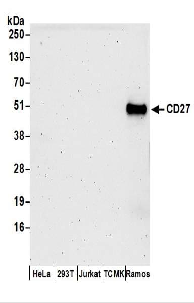Polyclonal Rabbit anti-Human CD27 Antibody (aa50-100, WB)