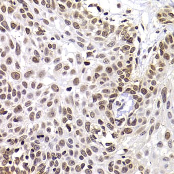 WDR11 / PHIP Antibody