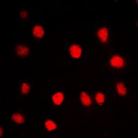 BRD3 Antibody (C-Terminus)