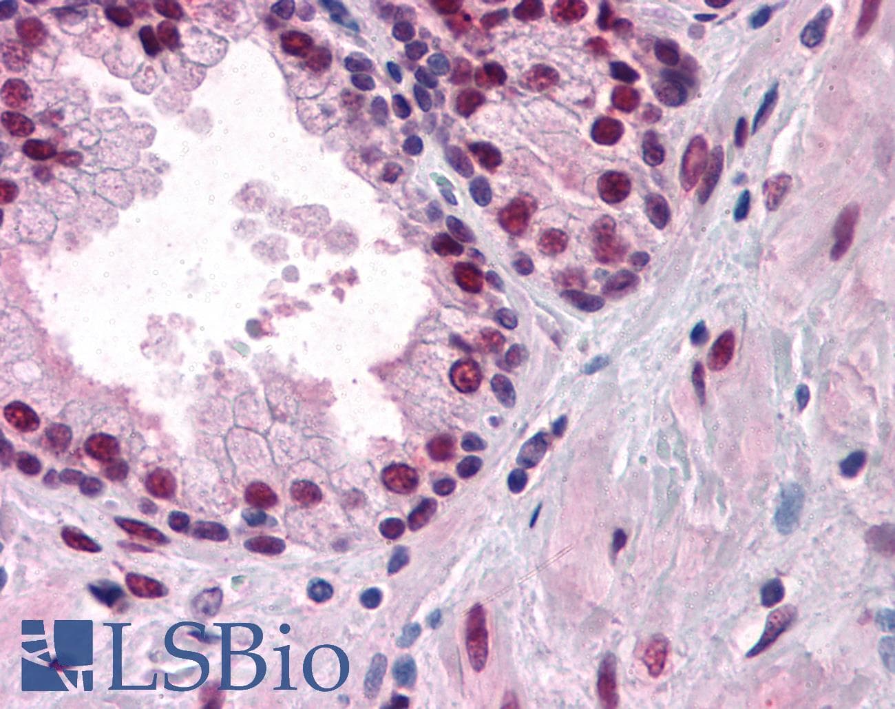 IHC-plus™ Monoclonal Mouse anti-Human AR / Androgen Receptor Antibody (clone 2H8, IHC, WB)