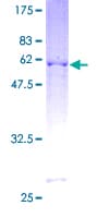 Human BTG3 Protein (Recombinant GST)