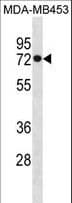 HSPA1L Antibody (aa576-603)