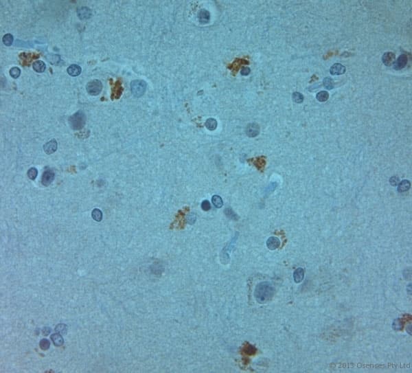 TJP2 / ZO2 / ZO-2 Antibody (aa740-790)