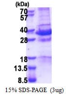 Human MAGED1 / NRAGE Protein (Recombinant His)