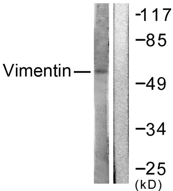 Polyclonal Rabbit anti-Human Vimentin Antibody (p56, IHC, WB)