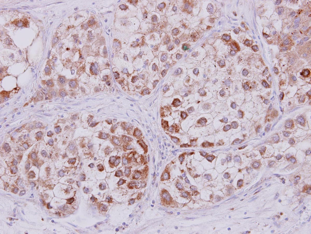 SCG10 / STMN2 Antibody (aa2-41)
