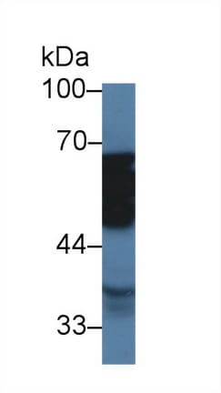 TUBD1 / Tubulin Delta Antibody (aa190-453, PE)