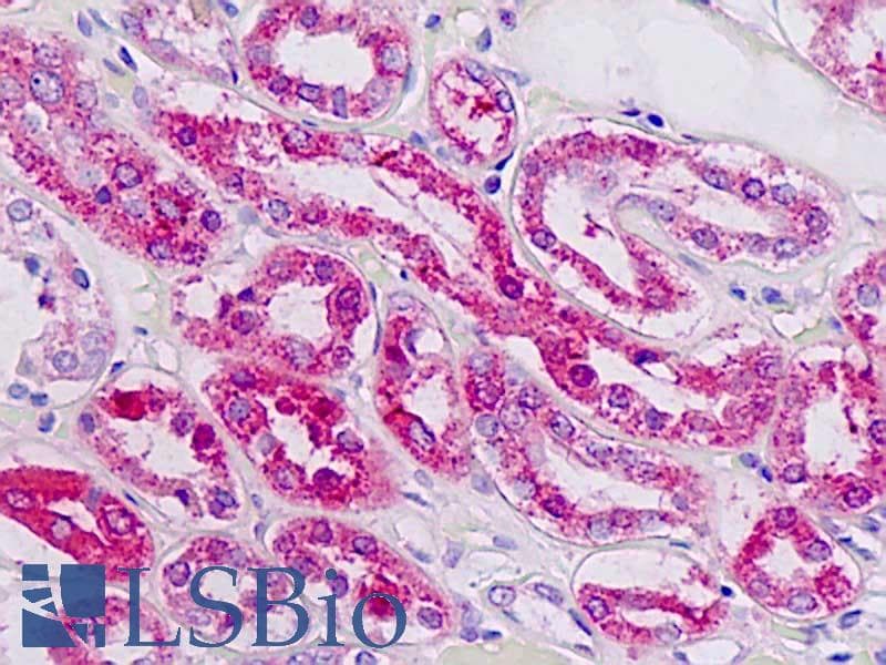 IHC-plus™ Polyclonal Rabbit anti-Human PLAGL1 / ZAC Antibody (aa311-360, IHC, WB)