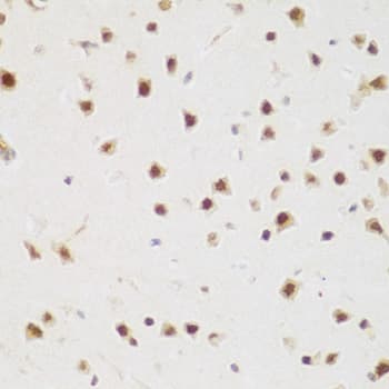 Polyclonal Rabbit anti-Human BRD9 Antibody (IHC, WB)
