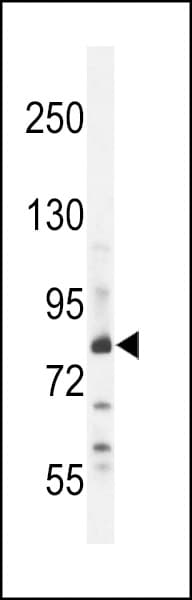 Polyclonal Rabbit anti-Human ZNF180 Antibody (aa103-132, IHC, WB)