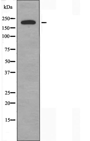 Polyclonal Rabbit anti-Human PEAK1 / SGK269 Antibody (IF, WB)