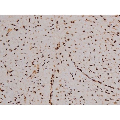 FAK / Focal Adhesion Kinase Antibody (phospho-Tyr397)