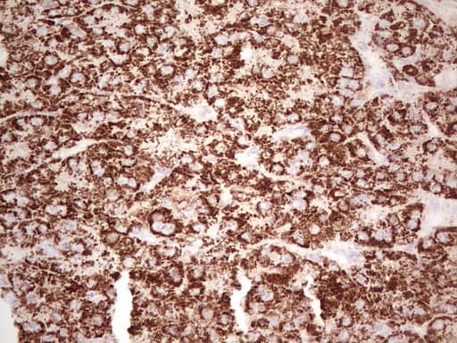 Monoclonal Mouse anti-Human ABAT Antibody (clone OTI6H1, aa29-323, IHC, WB)
