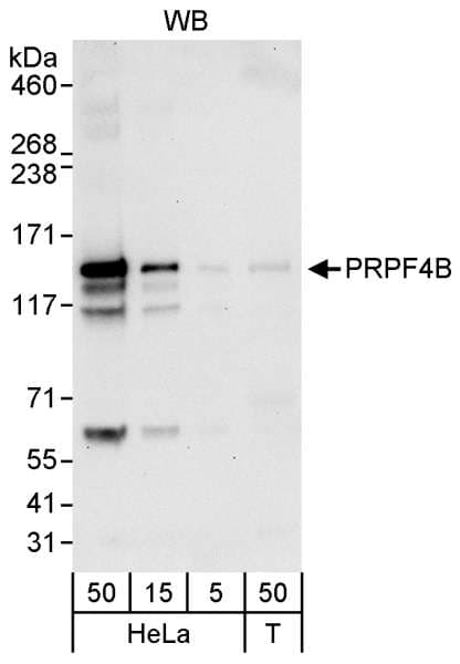 PRPF4B Antibody (aa1-50)