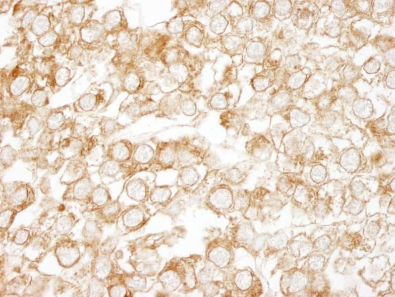 EPS15 Antibody (aa575-625)