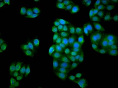 IBA57 / C1orf69 Antibody