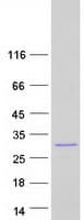 Human C3orf83 Protein (Recombinant Myc-DDK (Flag))