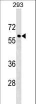 Polyclonal Rabbit anti-Human CACNB3 / Cavbeta3 Antibody (aa407-434, WB)