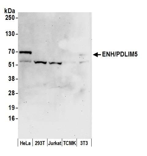 IHC-plus™ PDLIM5 / LIM Antibody (aa546-596)