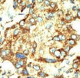 TRDMT1 / DNMT2 Antibody (aa346-375)