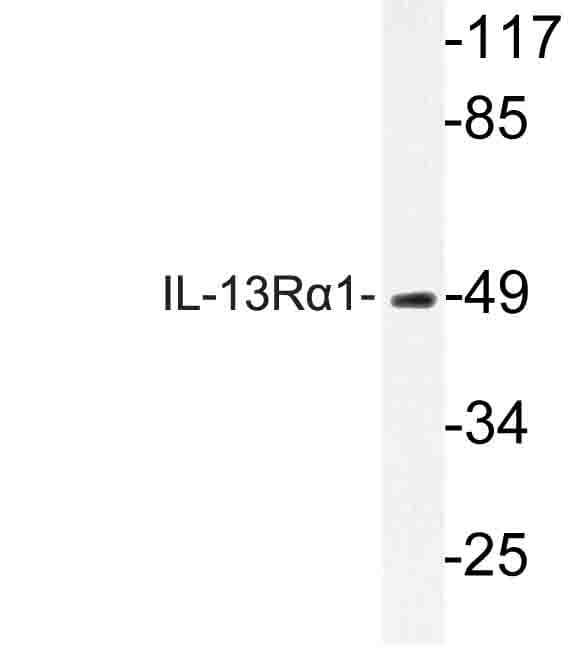 IHC-plus™ Polyclonal Rabbit anti-Human IL13RA1 / IL13R Alpha 1 Antibody (Lys401, IHC, IF, WB)