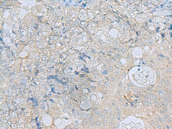 Polyclonal Rabbit anti-Human C16orf48 Antibody (IHC)