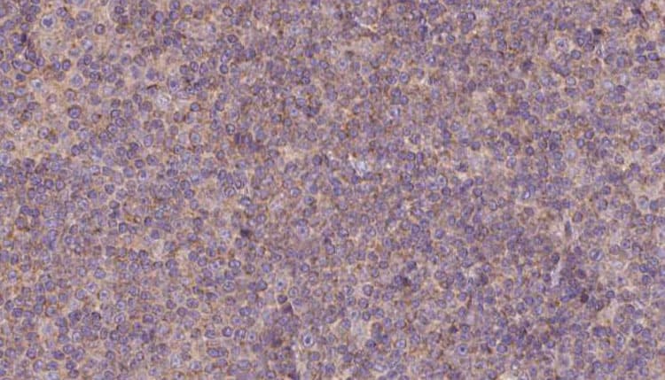 Polyclonal Rabbit anti-Human MDH1 Antibody (IHC, IF, WB)
