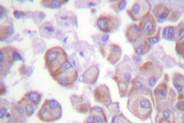 Polyclonal Rabbit anti-Human SNCA / Alpha-Synuclein Antibody (Glu123, IHC, WB)