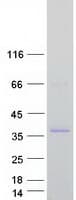 Human TGIF1 Protein (Recombinant Myc-DDK (Flag))