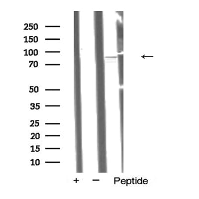 ATRIP Antibody