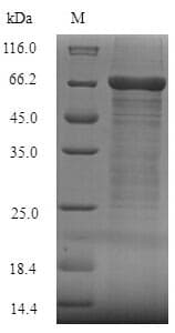 Human FCRL4 / IRTA1 / CD307d Protein (Recombinant 6His-SUMO, N-terminus)