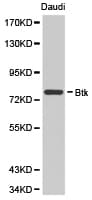 Polyclonal Rabbit anti-Human BTK Antibody (IHC, WB)