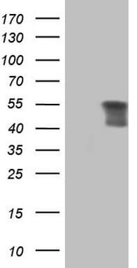 Peripherin Antibody (clone OTI7D8)