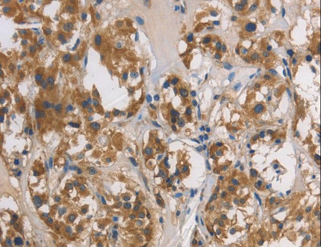 DUSP26 / MKP8 Antibody