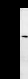 BAZ1B / WSTF Antibody (clone BAZ1H4H9)