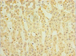 Polyclonal Rabbit anti-Human SGSH Antibody (aa273-502, IHC)