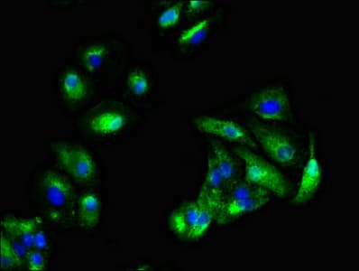 KRAS Antibody (aa2-168)