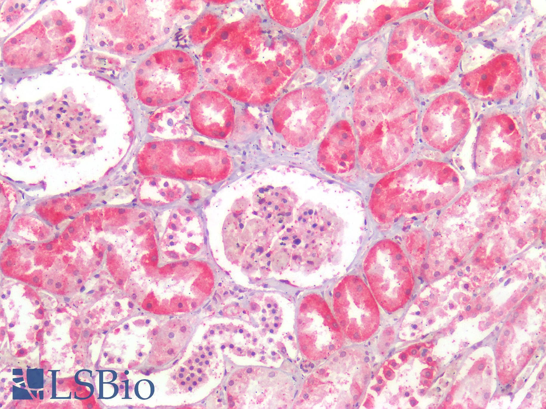PathPlus™ NDRG1 Antibody (aa382-394)