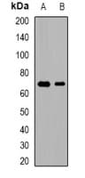 PHF19 Antibody