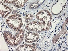 Monoclonal Mouse anti-Human MTFMT Antibody (clone OTI1E7, aa175-389, IHC, WB)