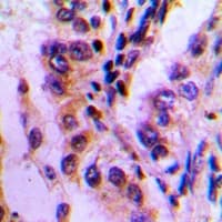 Polyclonal Rabbit anti-Human BAG3 / BAG-3 Antibody (Internal, IHC, WB)