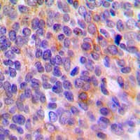 TOLLIP Antibody (Internal)