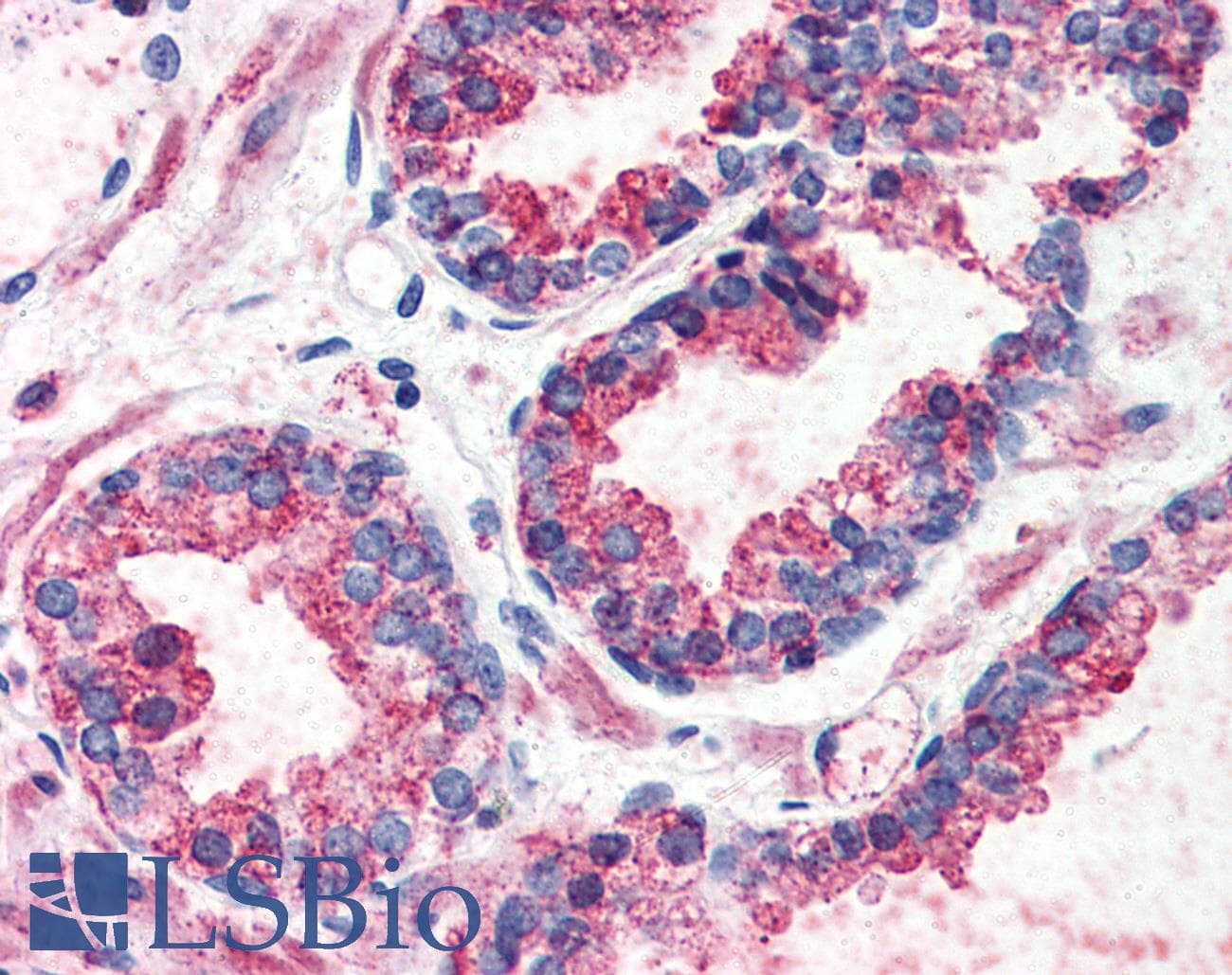 IHC-plus™ ADGRG6 / GPR126 Antibody (N-Terminus)