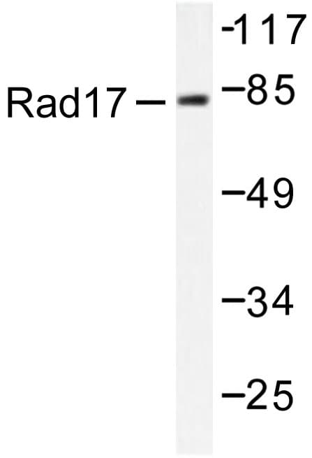 RAD17 Antibody (Ala639)