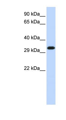 Polyclonal Rabbit anti-Human SIP1 Antibody (C-Terminus, WB)