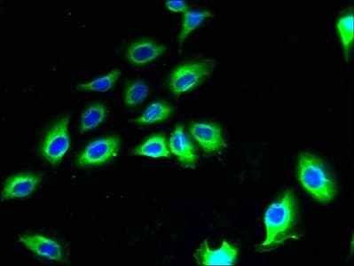 Polyclonal Rabbit anti-Human CNIH2 Antibody (IHC, WB)