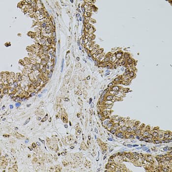 SELP / P-Selectin / CD62P Antibody