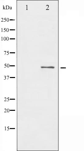 BLNK Antibody
